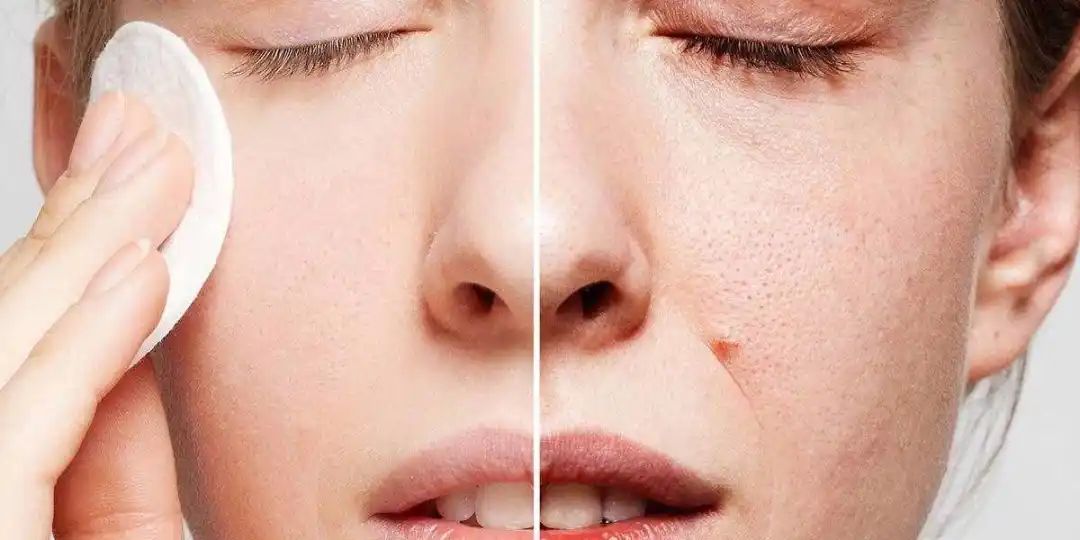 生物護膚品 生物護膚品