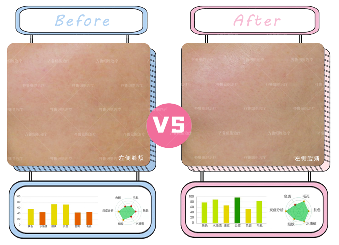 美白護膚品 美白護膚品